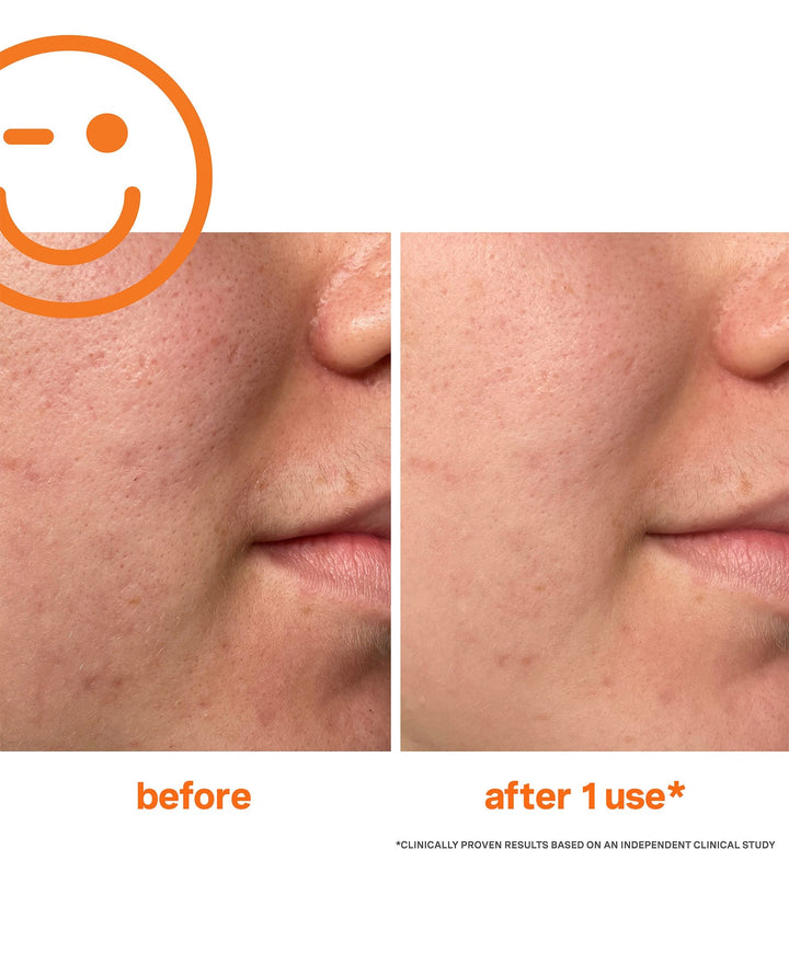 Kate Somerville ExfoliKate Intensive Exfoliating Treatment 60ml