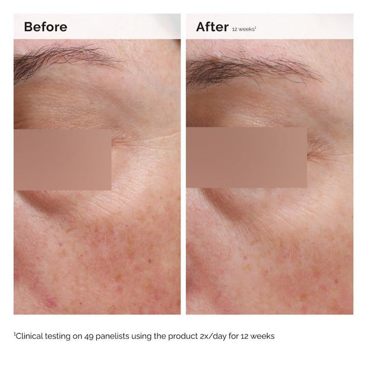 The Ordinary Niacinamide 5% Face & Body Emulsion 100ml