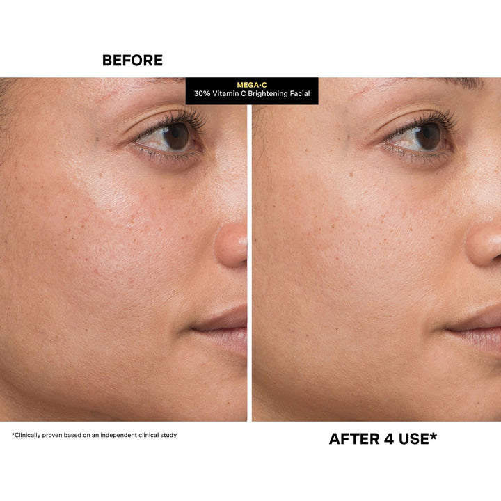 Kate Somerville Mega C 30% Vitamin C Brightening Facial 60ml