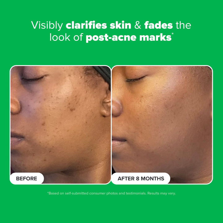Paula's Choice 10% Azelaic Acid Booster for Redness Relief 30ml